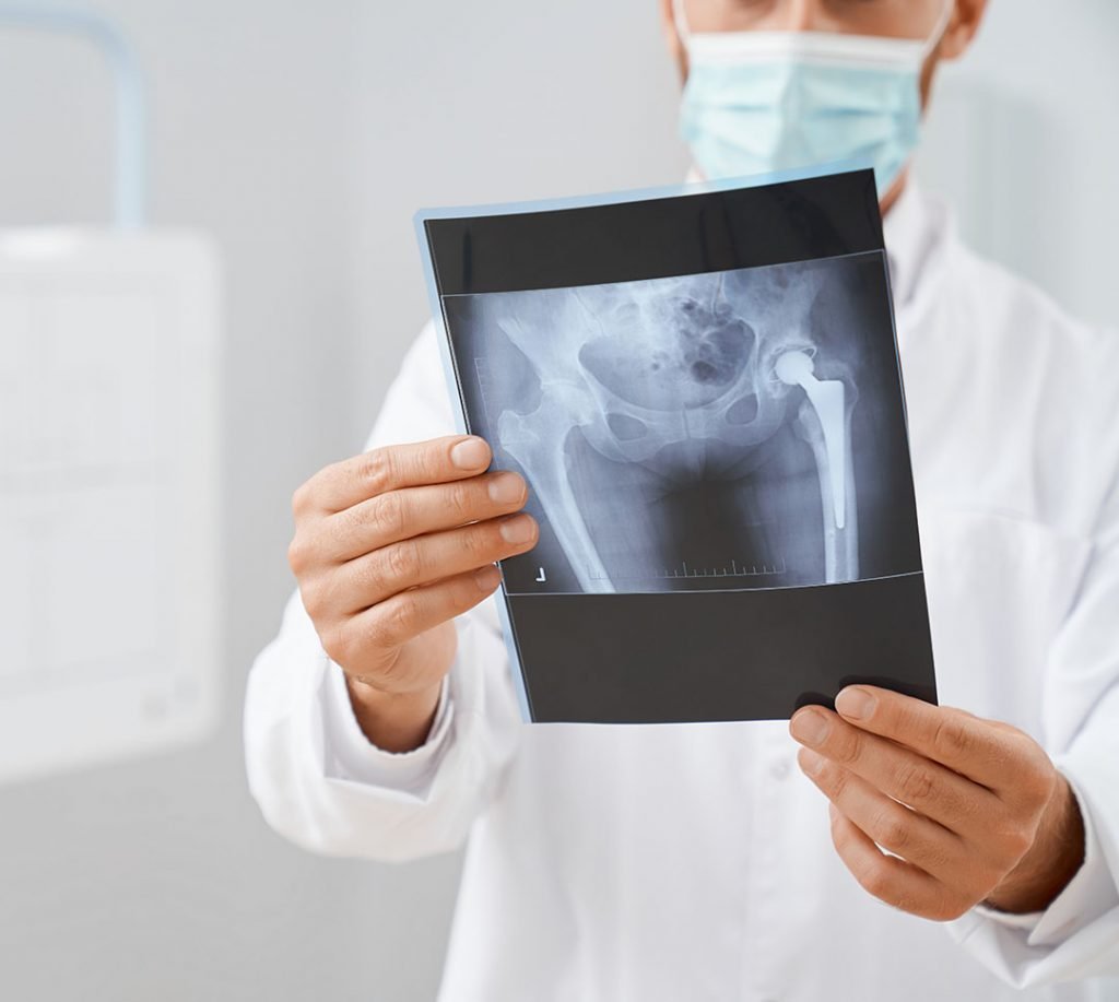 scan with image of pelvis and hip bone