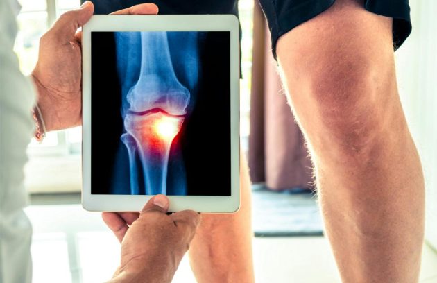 Orthopedic Doctor